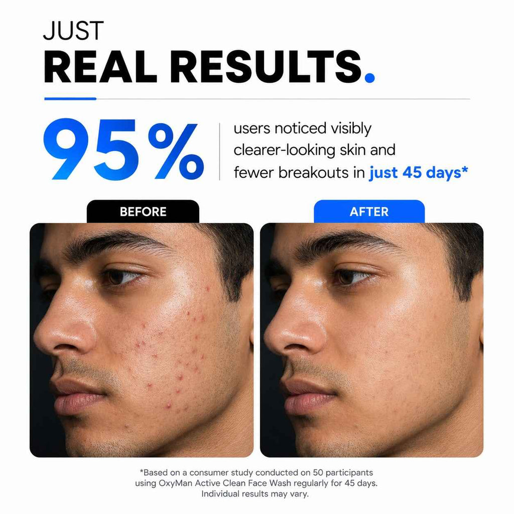 Active Clean Face Wash (100ml) | For Normal, Oily or Combination Skin