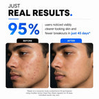 Active Clean Face Wash (100ml) | For Normal, Oily or Combination Skin