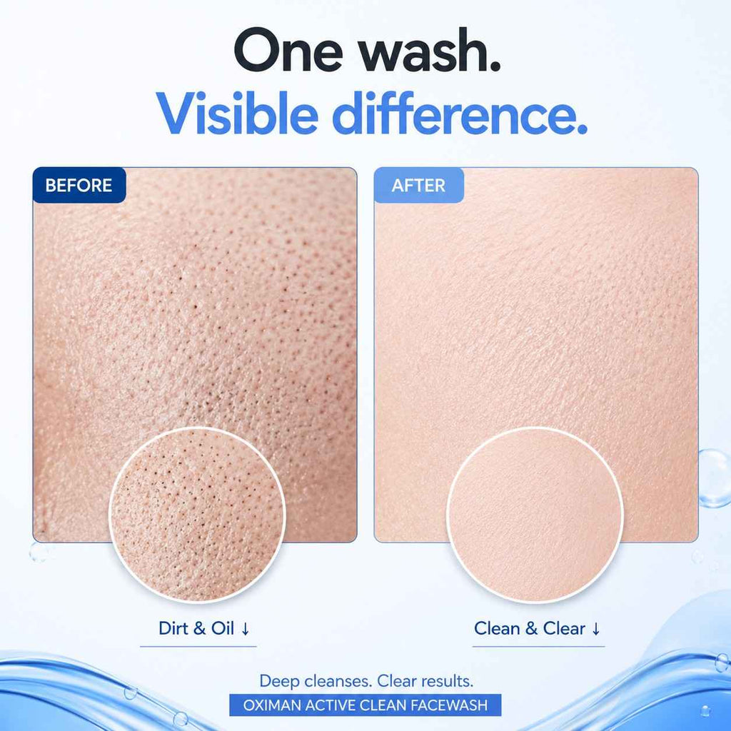 Active Clean Face Wash (100ml) | For Normal, Oily or Combination Skin
